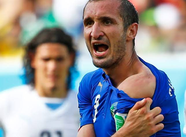 Giorgio Chiellini showing the camera the wonders of Suarez's teeth on his shoulder 