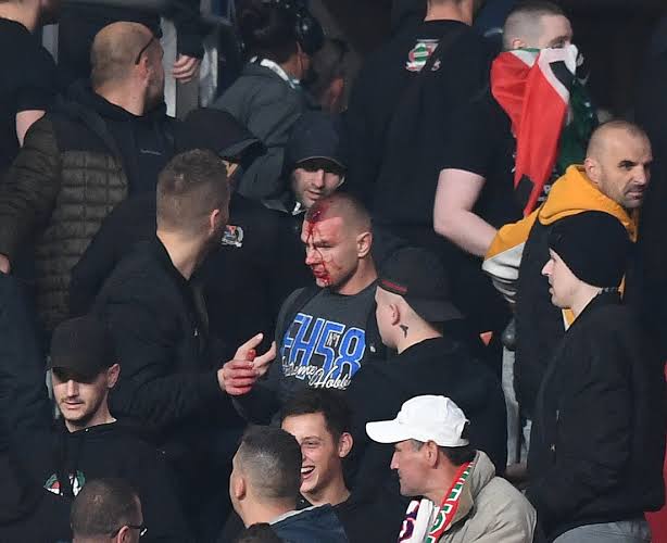 A Hungary fan left with a bleeding face after the crowd trouble at Wembley Stadium on Tuesday. 