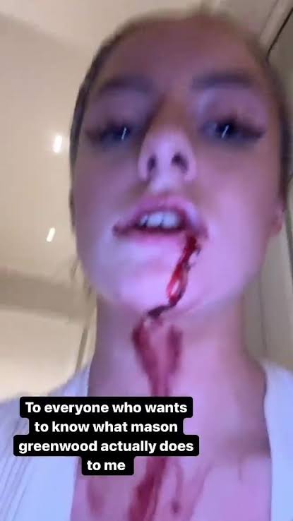Mason Greenwood is in a big mess, his girlfriend Harriet Robson shows proof that he sexually and physically abused her