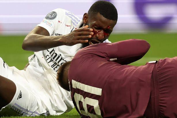 Antonio Rudiger Shares Hilarious Update After Leaving The Pitch Covered In Blood Stains