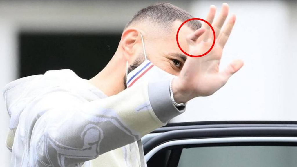 Karim Benzema And The Little Finger Story