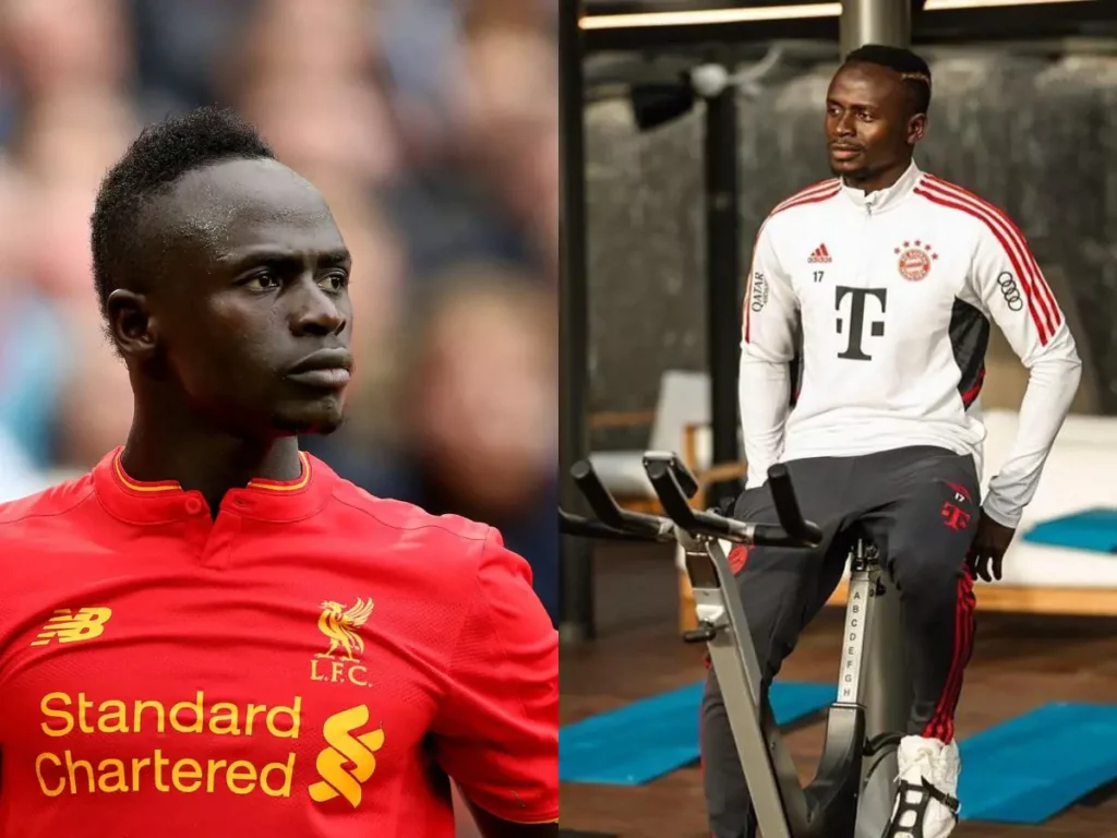 Before and after picture of Sadio Mane's hair transplant