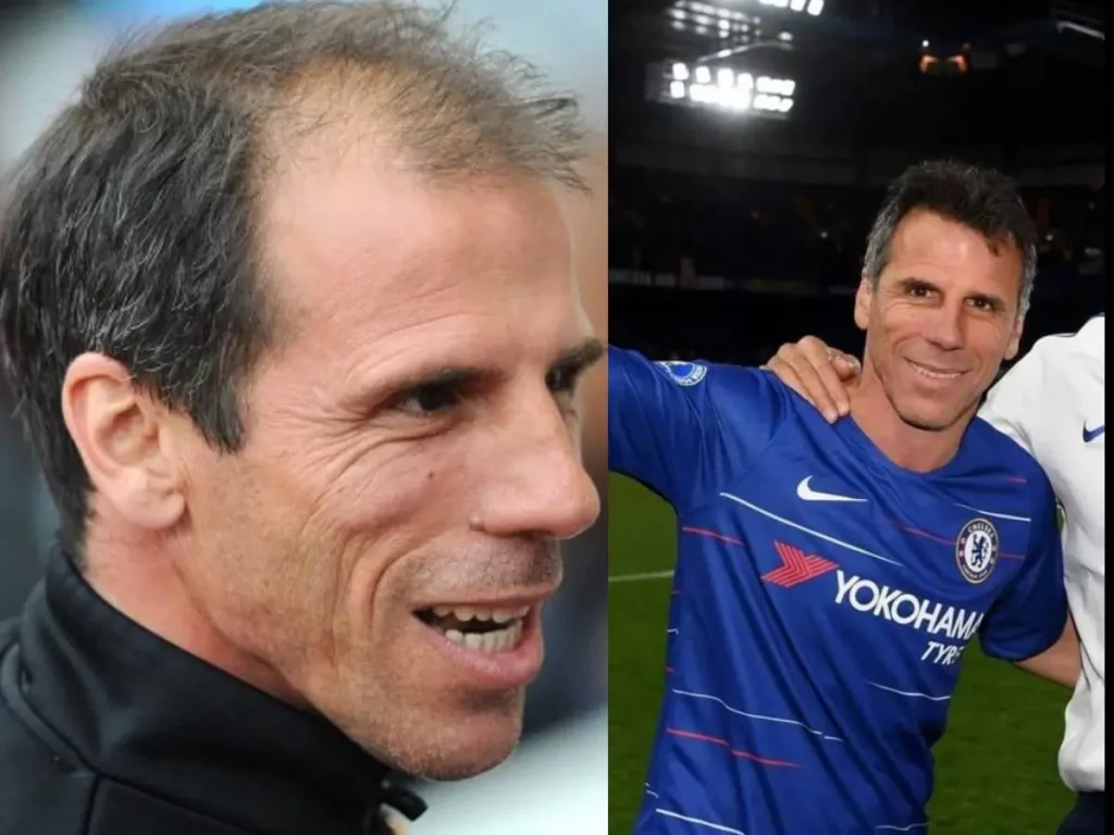 Before and after picture of Gianfranco Zola's hair transplant