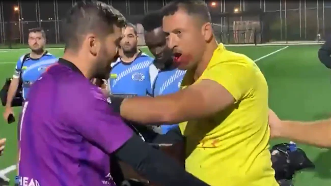 Khoder Yaghi, An Australian Referee, Was Left With A Broken Jaw After Player Attacked Him