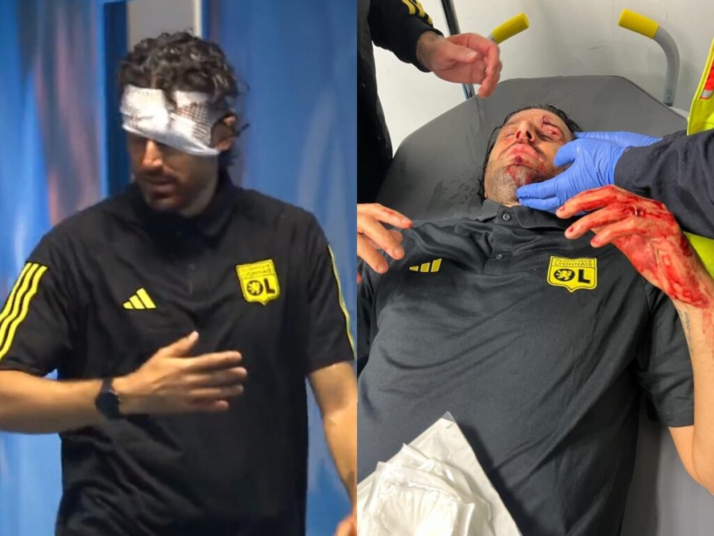 Lyon Manager Fabio Grosso Injured After Attack In Marseille