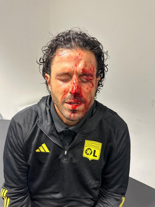 Lyon Manager Fabio Grosso Injured After Attack In Marseille